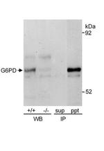 Glucose-6-Phosphate Dehydrogenase Antibody in Immunoprecipitation (IP)
