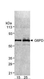 Glucose-6-Phosphate Dehydrogenase Antibody in Western Blot (WB)