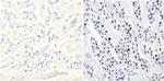 DNMT3B Antibody in Immunohistochemistry (Paraffin) (IHC (P))