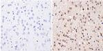 DNMT3B Antibody in Immunohistochemistry (Paraffin) (IHC (P))