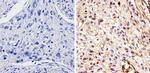 DMAP1 Polyclonal Antibody