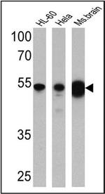 DMAP1 Antibody in Western Blot (WB)