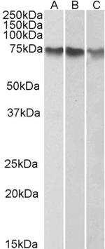 ATF2 Polyclonal Antibody