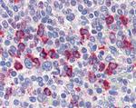 CD14 Antibody in Immunohistochemistry (Paraffin) (IHC (P))