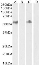 CD14 Antibody in Western Blot (WB)