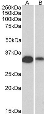 CD20 Antibody in Western Blot (WB)