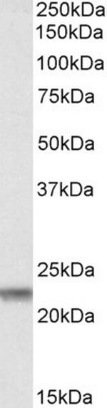 Claudin 14 Antibody in Western Blot (WB)