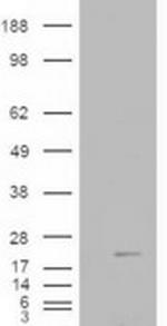 Cofilin 2 Antibody in Western Blot (WB)