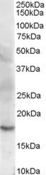 Cofilin 2 Antibody in Western Blot (WB)