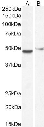 FOXG1 Polyclonal Antibody