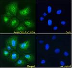 FOXP3 Antibody in Immunocytochemistry (ICC/IF)