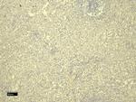 FOXP3 Antibody in Immunohistochemistry (Paraffin) (IHC (P))