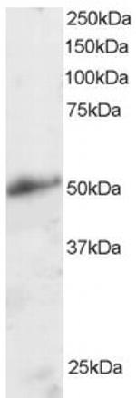 KLF8 Antibody in Western Blot (WB)