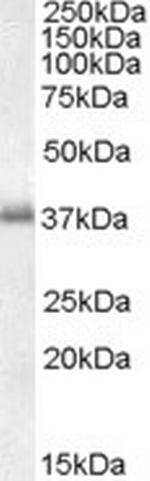 LAT Polyclonal Antibody