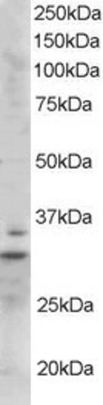 LIME Polyclonal Antibody