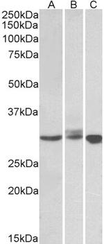 Livin Polyclonal Antibody
