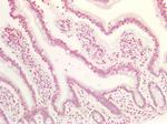 MAX Antibody in Immunohistochemistry (Paraffin) (IHC (P))