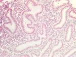 MAX Antibody in Immunohistochemistry (Paraffin) (IHC (P))