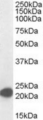 MAX Antibody in Western Blot (WB)