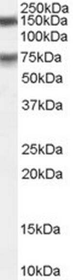 MELK Polyclonal Antibody