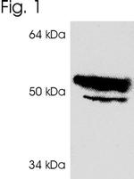 IP6K2 Antibody in Western Blot (WB)