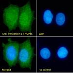 NUP85 Polyclonal Antibody