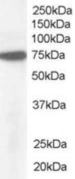 NUP85 Antibody in Western Blot (WB)