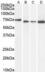 NUP85 Antibody in Western Blot (WB)