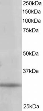 PITPN Antibody in Western Blot (WB)