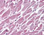 PPP2R1A Antibody in Immunohistochemistry (Paraffin) (IHC (P))