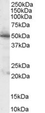 PDHX Antibody in Western Blot (WB)
