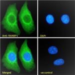RANBP1 Polyclonal Antibody