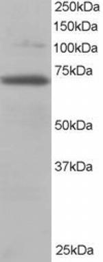 RANGAP1 Antibody in Western Blot (WB)