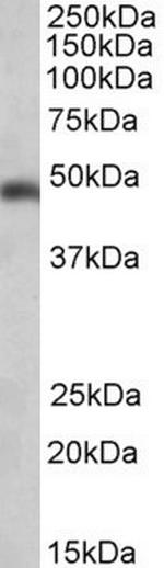 SEC61A1 Antibody in Western Blot (WB)