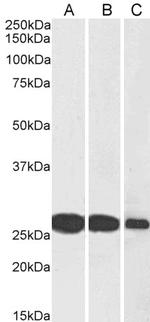 SNAP25 Polyclonal Antibody