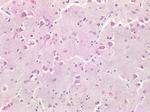 Survivin Antibody in Immunohistochemistry (Paraffin) (IHC (P))