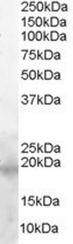 Survivin Antibody in Western Blot (WB)