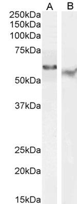 TFEB Antibody in Western Blot (WB)