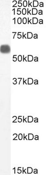 TFEB Antibody in Western Blot (WB)