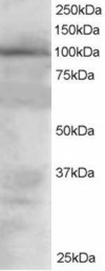 VAV2 Antibody in Western Blot (WB)