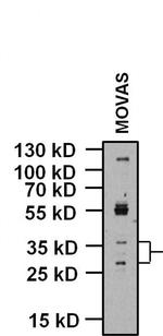 KCNMB1 Antibody in Western Blot (WB)