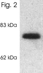SLC24A2 Antibody in Western Blot (WB)
