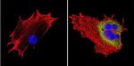 VDAC3 Antibody in Immunocytochemistry (ICC/IF)