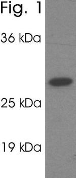 PSME1 Polyclonal Antibody