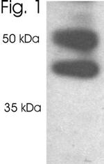 PSMD2 Antibody in Western Blot (WB)