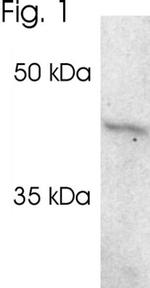 PSMC5 Antibody in Western Blot (WB)