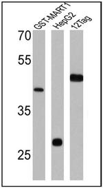 GST Tag Polyclonal Antibody