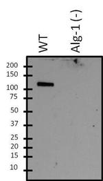 ALG1 Polyclonal Antibody