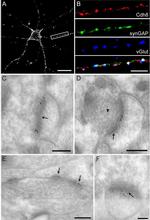 SynGAP Antibody in Immunocytochemistry (ICC/IF)