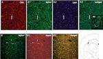 alpha-1a Adrenergic Receptor Antibody in Immunohistochemistry - Free Floating (IHC (Free))
